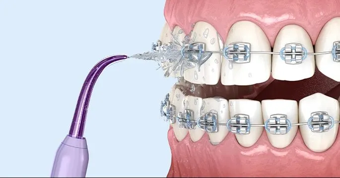 Flossing